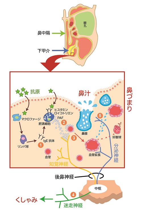 症 喉 イガイガ 花粉